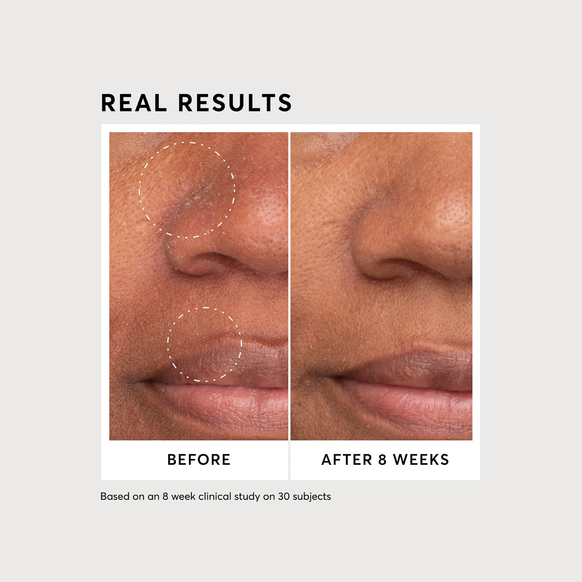 Niacinamide Serum 12% Plus Zinc 2%  - Jumbo