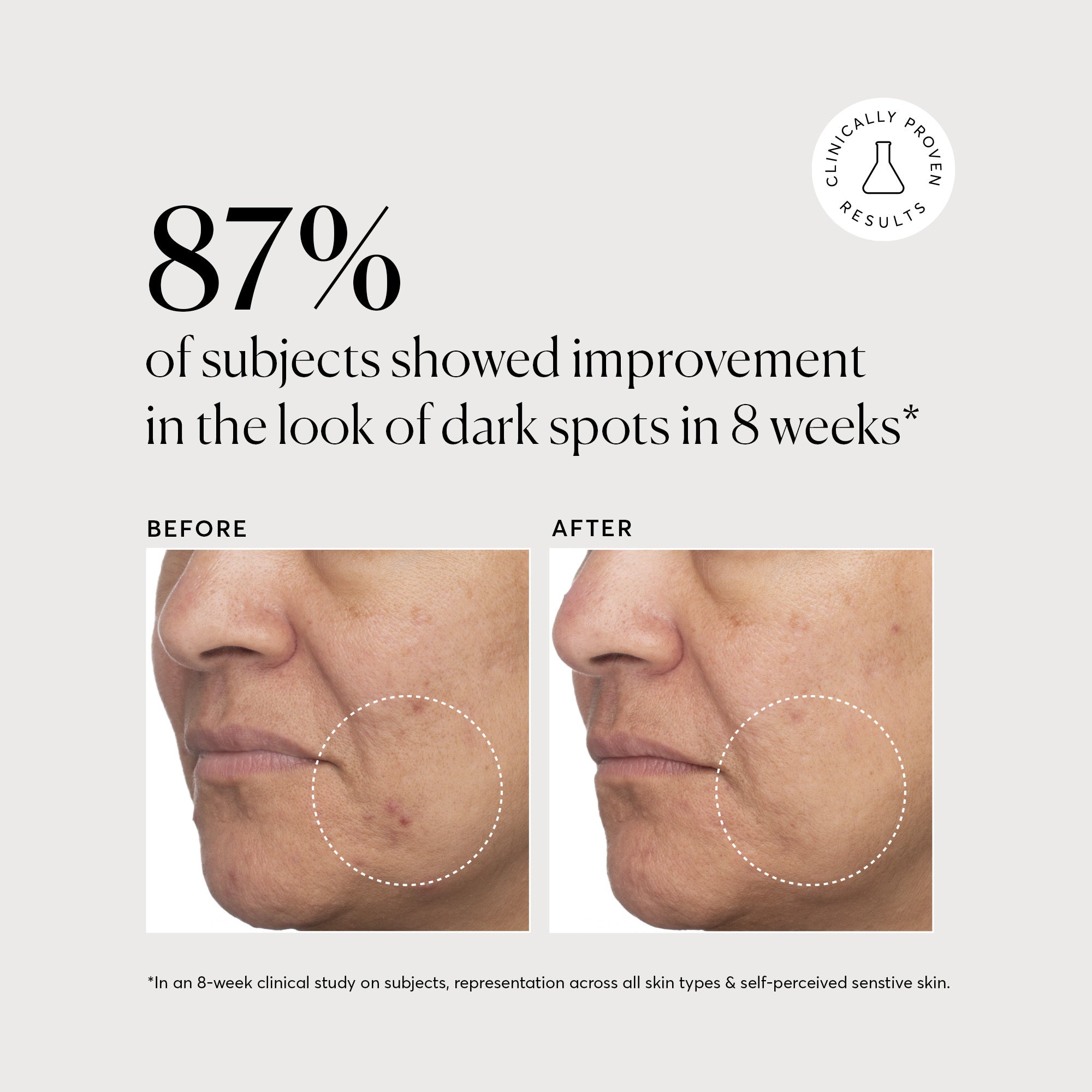 Tranexamic Topical Acid 5%